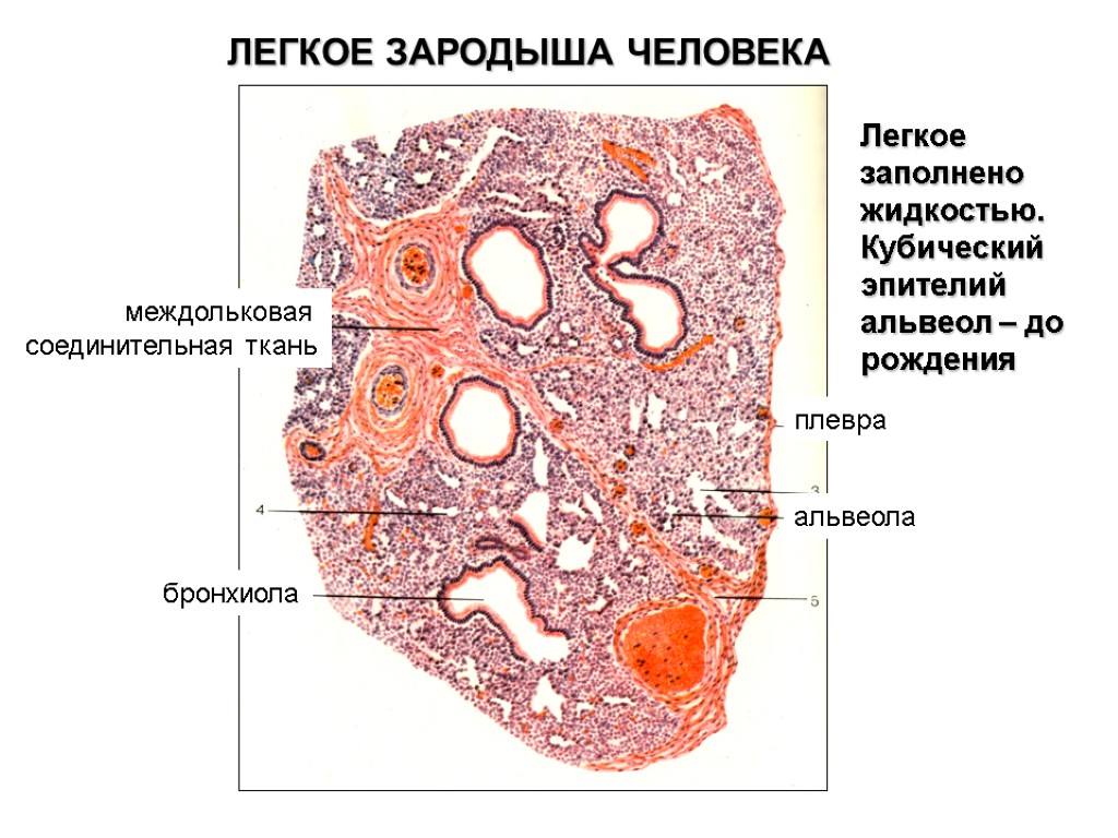 ЛЕГКОЕ ЗАРОДЫША ЧЕЛОВЕКА Легкое заполнено жидкостью. Кубический эпителий альвеол – до рождения